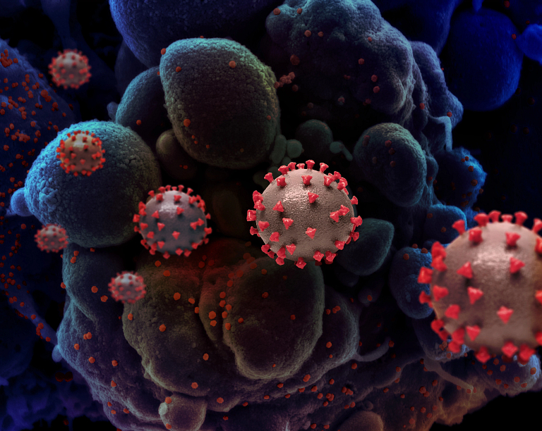 An image of the SARS-CoV-2 virus