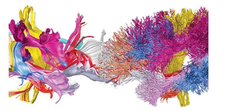 Two different, colorful methods to map white matter in the human brain