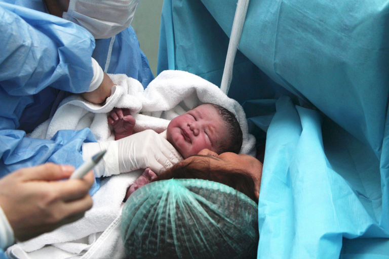 A newborn baby in the delivery room