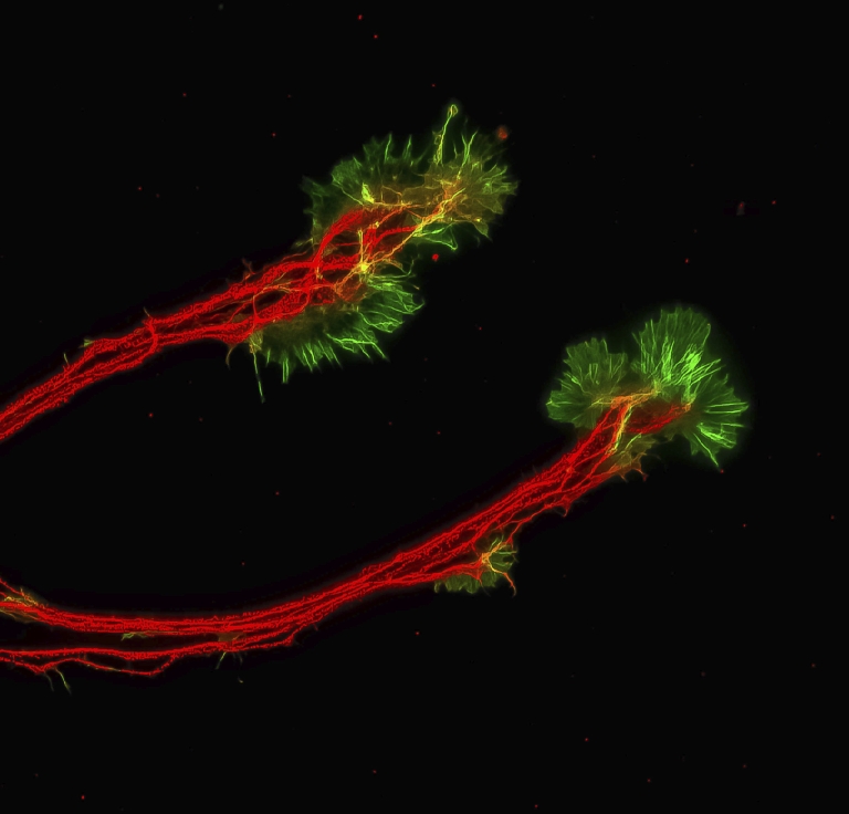 Red axons of retinal ganglion cells derived from human pluripotent stem cells bundle together.