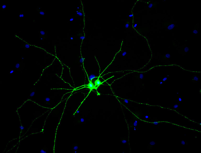 Examples of retinal ganglion cells (green) derived from human pluripotent stem cells