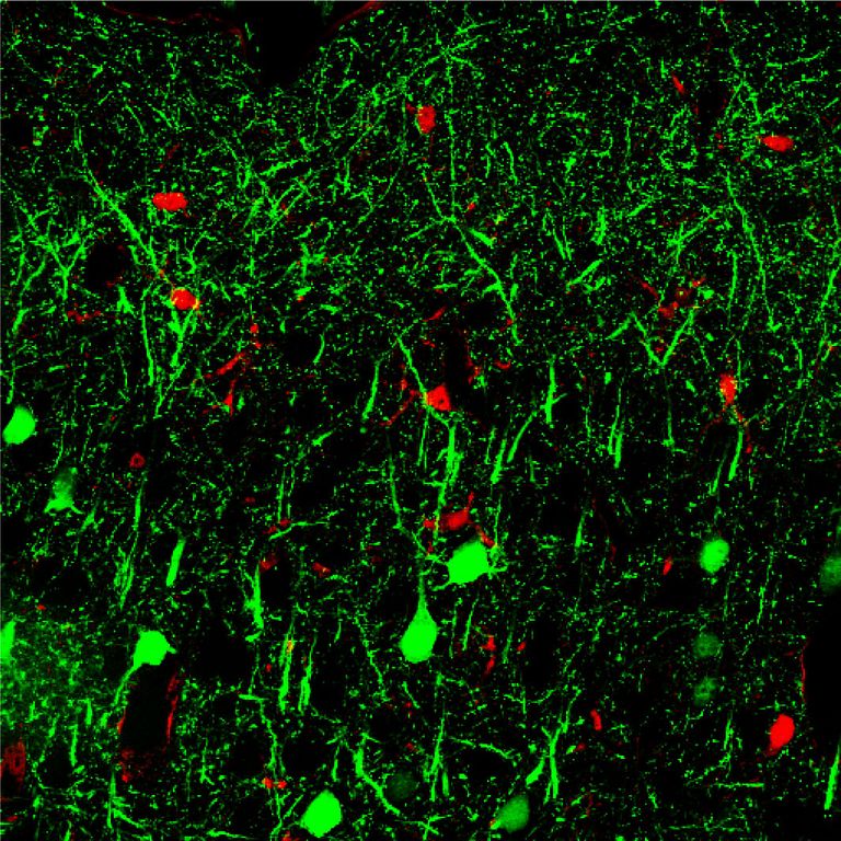 microRNA 142 appears in green in neurons in the brain
