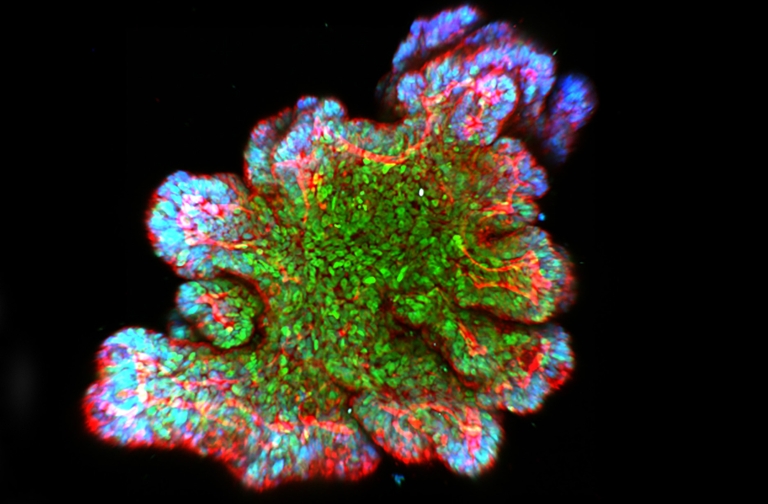 Colorectal cancer organoid