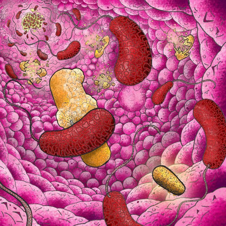 One of professor McKinlay's pieces describing a swarm of Vibrio cholerae invading the intestine. 
