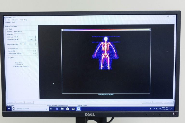 Image of skeleton produced by DEXA scan