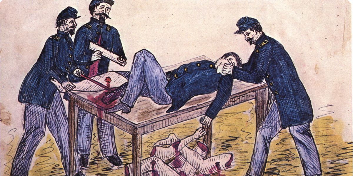 A drawing of an amputation during the Civil War