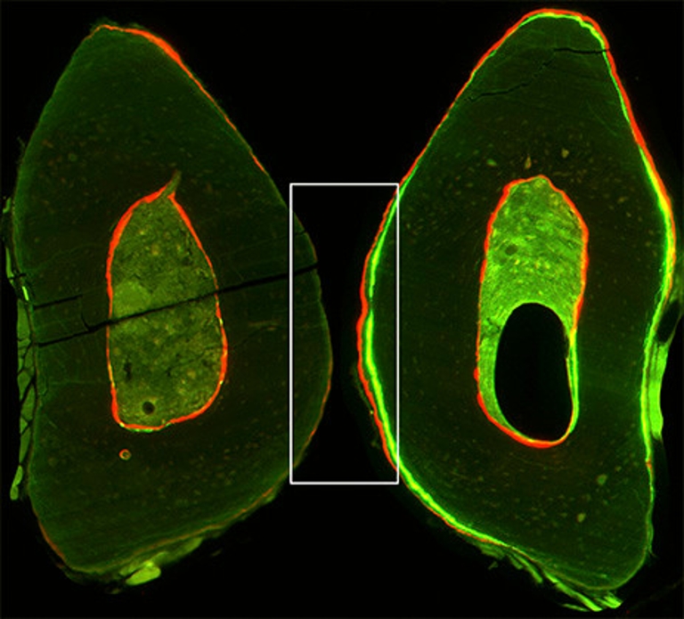 Image of a bone sample